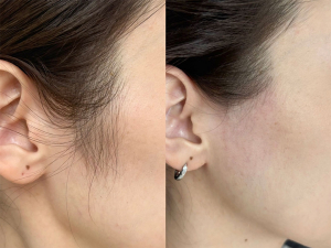 ☆新メニュー☆フェイスワックス